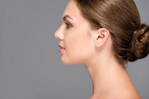 Rhinoplasty