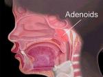 Geniz Eti (Adenoid)